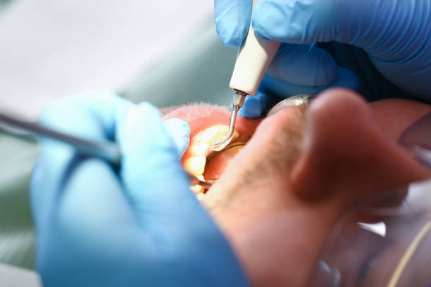 Best Dental Abscess Treatment in Camp Croft, SC